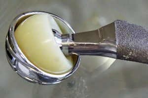 artificial joint implants of metal and plastic
